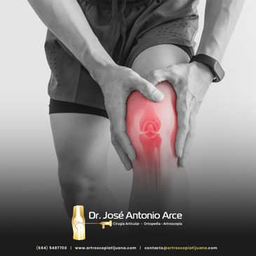 Slider image (2) ARTROSCOPIA TIJUANA